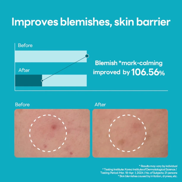 MEDIHEAL Madecassoside Blemish Repair Serum 40ml from Korea